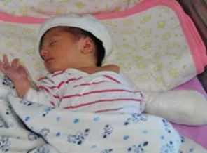 6 günlük bebeğin parmağını makasla kestiler