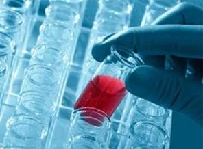 AIDS tedavisinde yeni umut