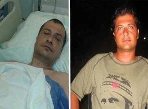 'Gezi'de polisin attığı demir bilye ile gözünü kaybetti