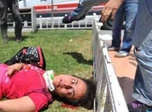 Gezi Parkı eylemlerinde yaralanan Lobna yürümeye başladı