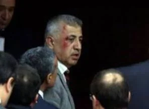 Kaşı yarılan vekil konuştu!