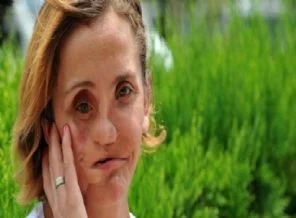 Yüz nakli bana yapılacak diye düşündüm