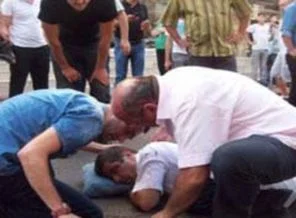 Belediye başkanına araba çarptı