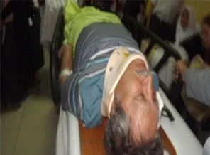 Hasan Gerçeker trafik kazası geçirdi
