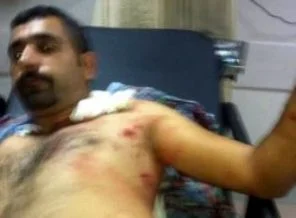 HDK'nın 'Rojava' eylemine bıçaklı saldırı