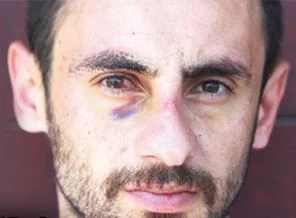 Kemik kıran polis dayağına 15 yıl