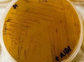 Okyanus çamurundan 'süper antibiyotik' keşfedildi