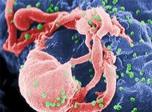 Aids salgını ne zaman bitecek?