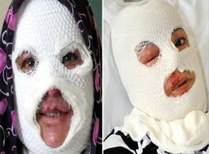 Düdüklü tencere kurbanları