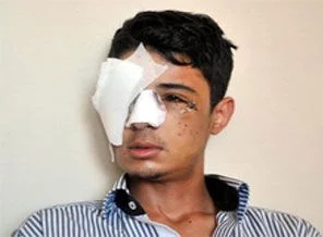 Kör eden polise şok 'ceza'