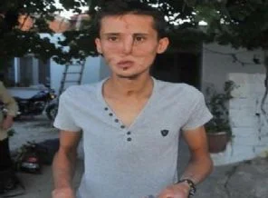 Yüz nakli sevinci iki saat sürdü
