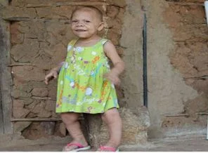 Hiç büyümeyecek çocukların tuhaf hikayesi(Foto Galeri)