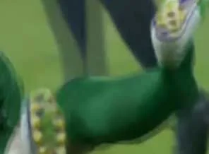 İranlı genç futbolcunun ayağı kırıldı! Kırılma sesini tribünler bile duydu!