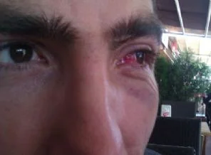 Polis polisi dövdü, meydan dayağı çekti!