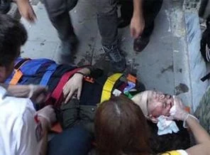 Yolda yürürken hastanelik oldu