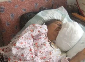 Yüzünden çıkan doktorları şoke etti