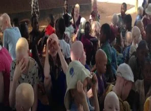 Afrika'nın 'beyaz' çocuklarına 'ilaç' niyetine tecavüz ve deri yüzme vahşeti!