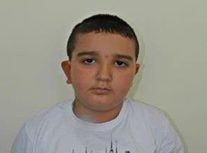 Doğuştan kulağı yok