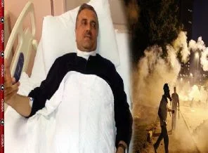 Gezi olaylarında boğazı kesilen AK Partili Başkan dehşet anlarını anlattı