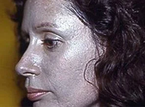 Burun damlası kullandı; 60 yıldır cildi gri