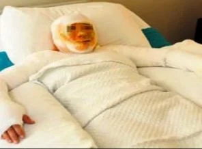 Eski eşine kezzap atana 12 yıl hapis