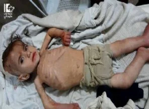 Farkında mısınız? Yermuk'te insanlık ölüyor