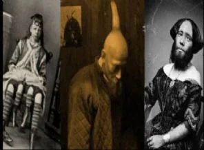 Milyonda bir görülen hastalıklar(Foto Galeri)