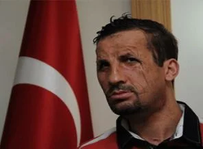 Türkiye yüz nakillerinde dünya liderliğine oynuyor