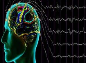 Epilepsiye ameliyatlı çözüm