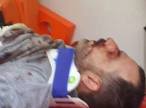 Gülsuyu'nda polislere saldırı:1 Polis hayatını kaybetti