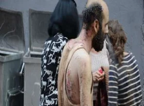 Taksim patlamasında en ilgi çeken kare