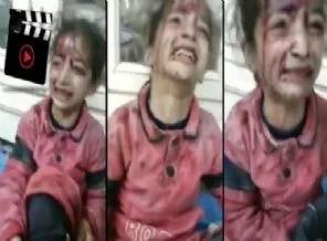 Yaralı kız: Amca yeni pijamamı kesme