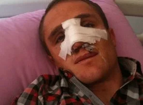 AK Partili genci darp eden CHP'liden itiraf
