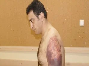 'Ağzına cop sokmak' basit yaralamadan çıktı!
