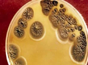 Antibiyotik bakterilerle başa çıkamıyor