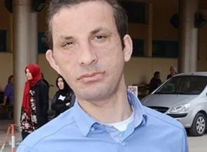 'Belki ameliyatta ölebilirdim ama...'