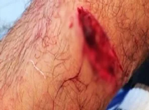 Şok saldırı! Futbolcuyu bu hale getirdiler!