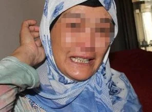Bu kadının vücudundan 'sinek' çıkıyor