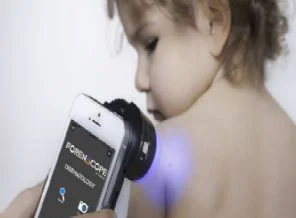 Cep telefonu ile erken teşhis