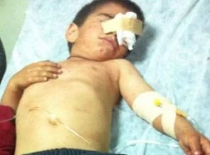 'Gaz kapsülü yaraladı' iddiası