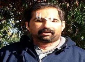 Nakledilen yüz geri alınıyor