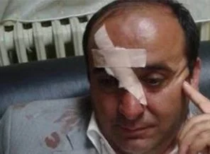 AK Partili Belediye Başkanını öldürüyorlardı