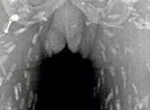 Doktorlar gözlerine inanamadı