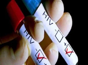 Diyarbakır'da HIV paniği
