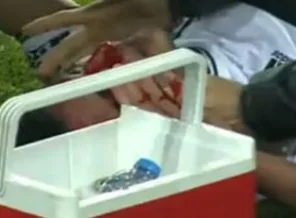 Mustafa Pektemek'in burnu kırıldı