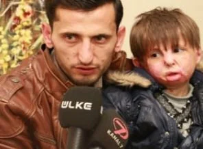Minik Vehbi tedavi için Türkiye'ye geldi