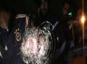 Yaralanan şoförle ilgili açıklama