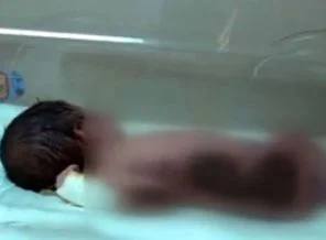 Yeni doğan bebeği 'Isıtacağız' diye yaktılar