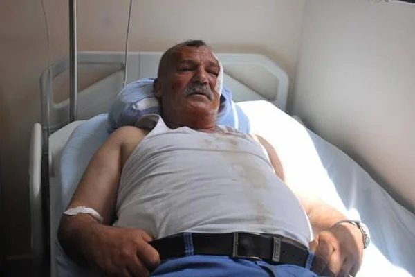 HDP saldırısında yaralananlar konuştu