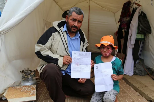 Suriyeli Emira'nın yüzündeki savaşın izleri silinecek